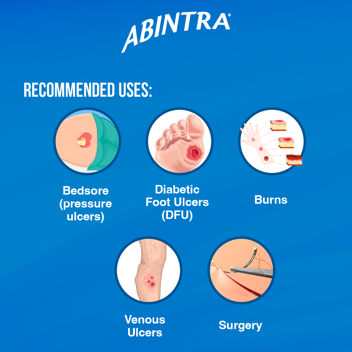 Abintra®
